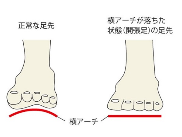 【神奈川県平塚市】開帳足を改善してジョギングを生涯スポーツに。コラル接骨院「市民ランナー駆け込み寺」